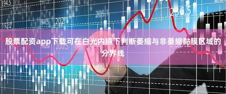 股票配资app下载可在白光内镜下判断萎缩与非萎缩黏膜区域的分界线